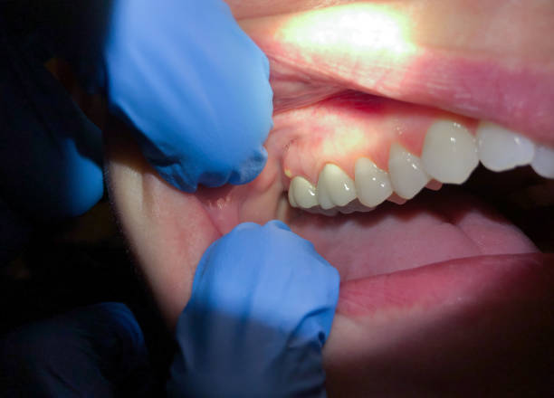 Best 24-Hour Emergency Dentist in North Pearsall, TX