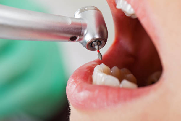 Best Emergency Dental Services for Seniors in North Pearsall, TX
